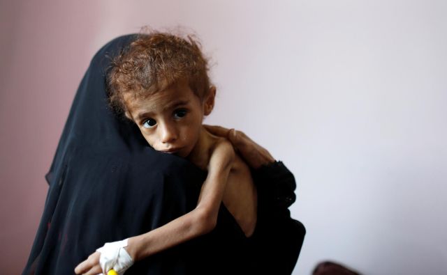 Podobe shiranih in umirajočih otrok iz Jemna so podobe prihodnjih vojn, v katerih bodo odigrale pomembno vlogo podnebne spremembe. FOTO:Reuters