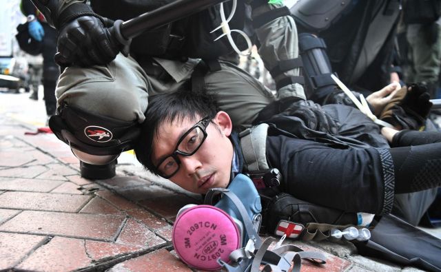Celo ko so pripadniki varnostnih sil proti demonstrantom uporabili gumijaste krogle, so posledice občutili vsi, ki so se znašli na njihovi poti. FOTO: Anthony Wallace/AFP