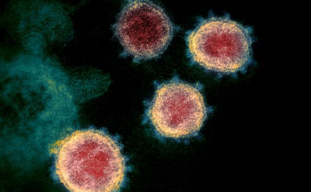 Po svetu se izvajajo projekti, ki se ukvarjajo z novim koronavirusom in temeljijo na umetni inteligenci. Raziskovalci že poročajo o pozitivnih rezultatih. Foto Reuters
