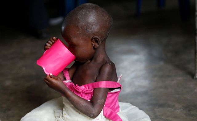 Prehransko najbolj ogroženi so ljudje, ki živijo na področjih, kjer divjajo vojne in tam, kjer so posledice podnebnih sprememb najhujše. Fotografije Reuters