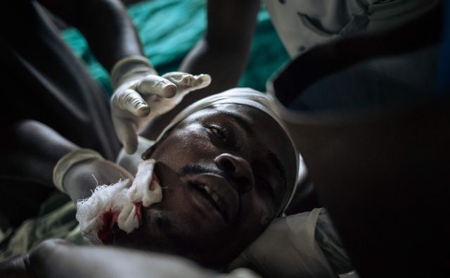 Januar 2020. 27-letni Kahese Kasereka se zdravi v bolnišnici Oicha, potem ko je bil včeraj huje ranjen v napadu neznanih storilcev v vasi Oichi. Oborožene sile DR Konga izvajajo operacije na ozemlju Beni proti oboroženi skupini ADF. Od začetka operacij je bilo severno od mesta Beni ubitih skoraj 300 civilistov. FOTO: Alexis Huguet/Afp