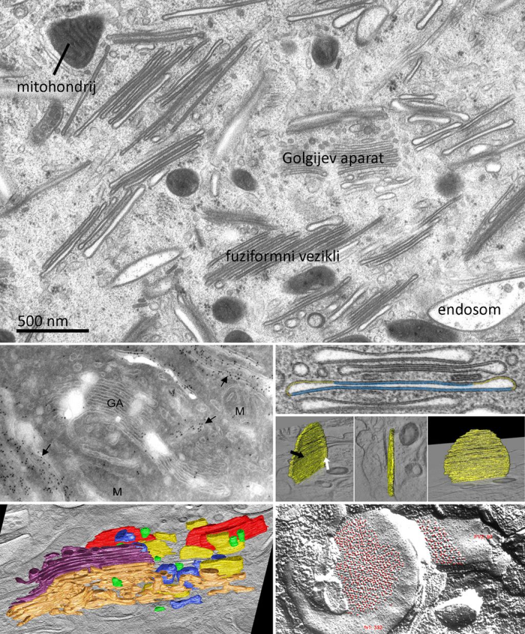 Ledena doba elektronske mikroskopije