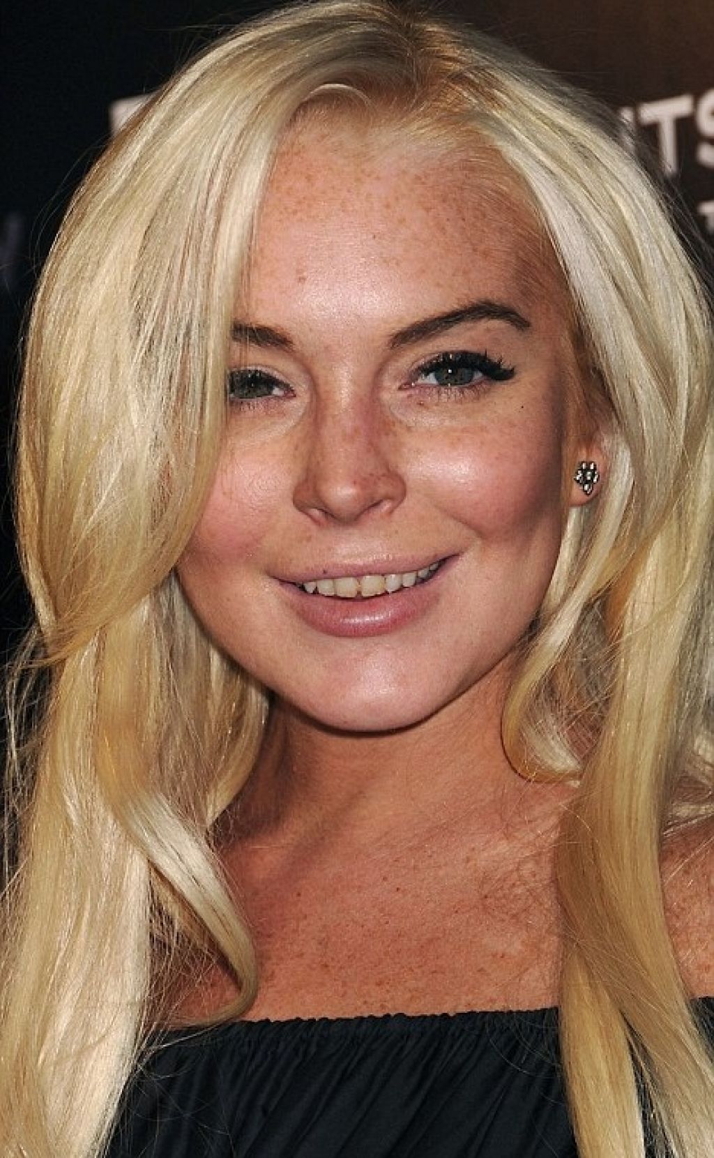 Lindsay Lohan (25) pokazala zanemarjene zobe