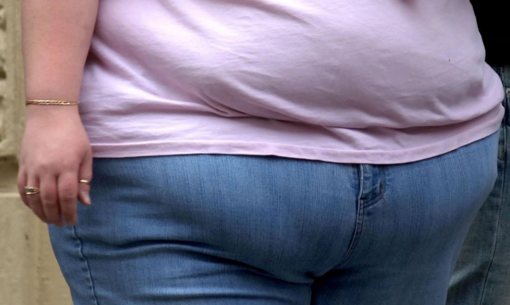 Kaj vse vpliva na čezmerno telesno težo in debelost