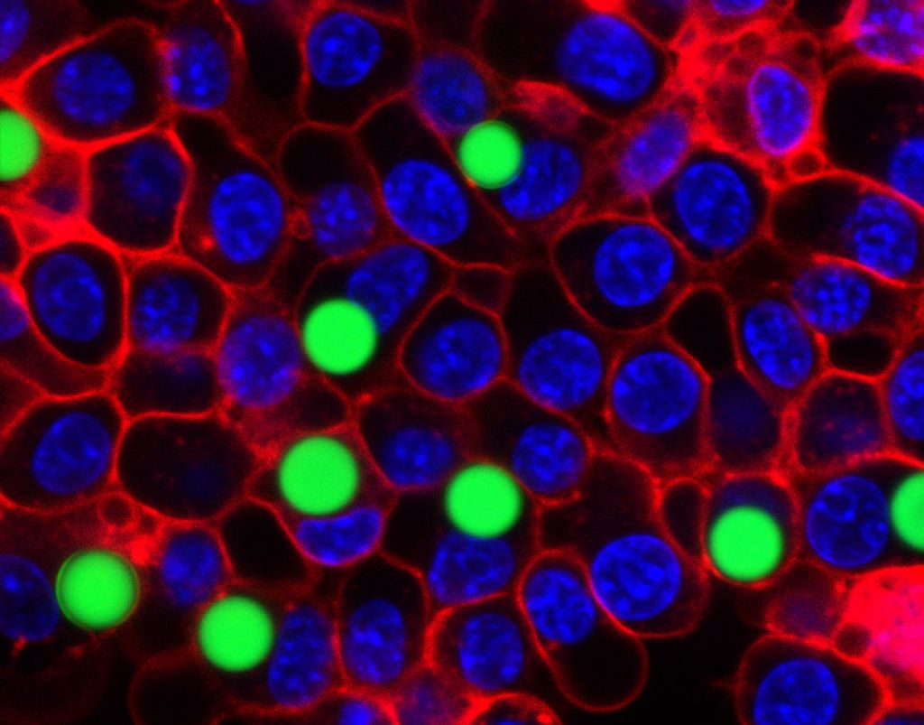Še en uspeh slovenskega znanja: laser vgrajen v človeško celico