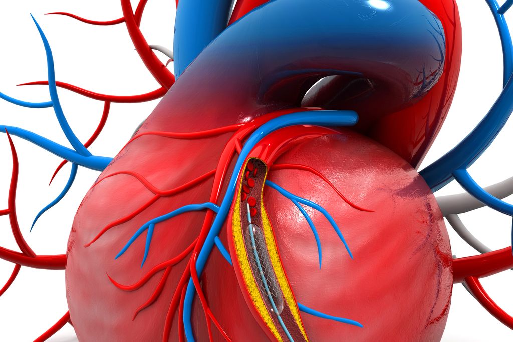 Srčno popuščanje: Zakaj pri nas še vedno ni mehanske podpore srca