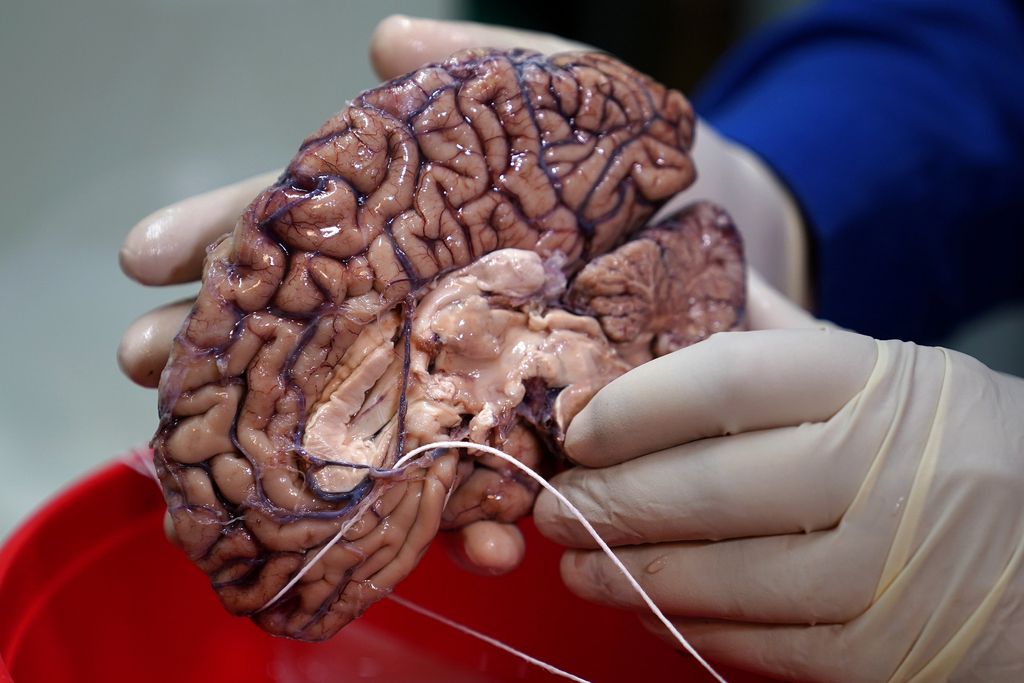 Banka človeških možganov